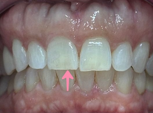 smile gallery image