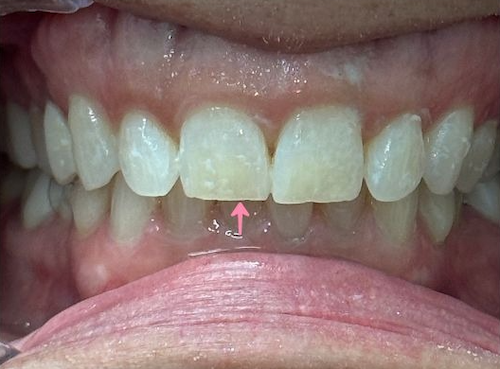 smile gallery image