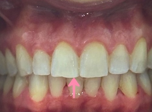 smile gallery image