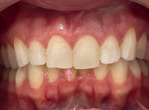 smile gallery image