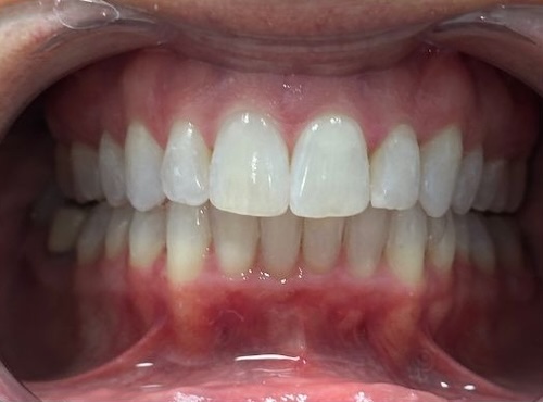 smile gallery image