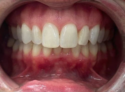 smile gallery image
