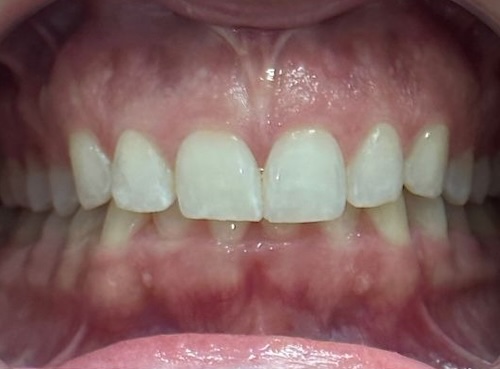 smile gallery image