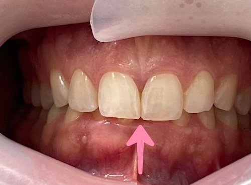 smile gallery image