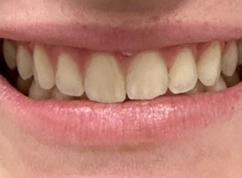 smile gallery image