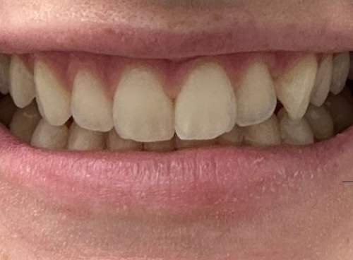 smile gallery image