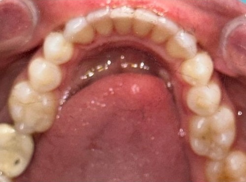 smile gallery image