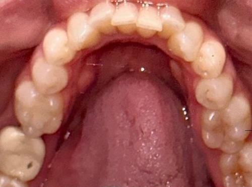smile gallery image