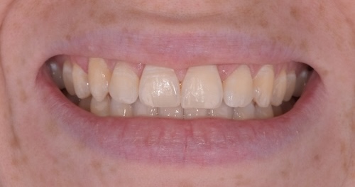 smile gallery image