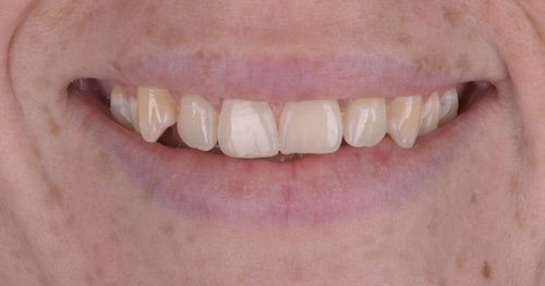 smile gallery image