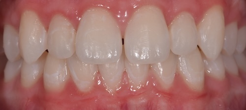smile gallery image