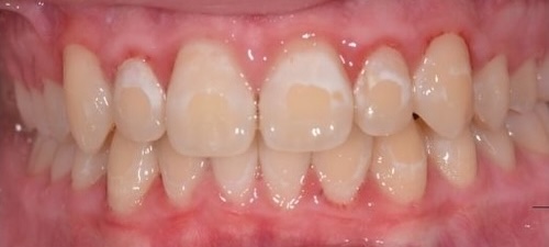 smile gallery image