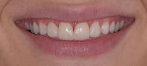 smile gallery image