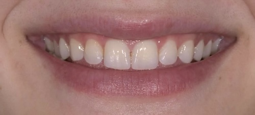 smile gallery image