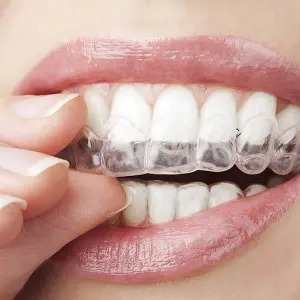 Invisalign in Purcelville