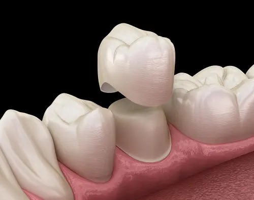 Restorative Dentistry in Purcellville
